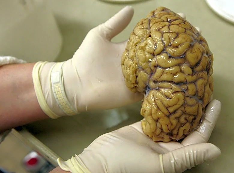 Scientists map gene activity in brain's prefrontal cortex