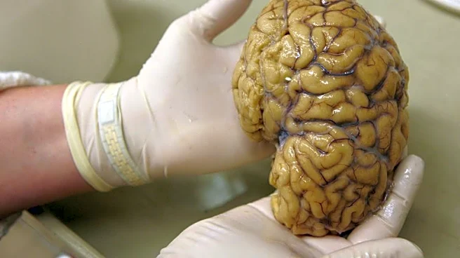 Scientists map gene activity in brain's prefrontal cortex