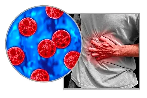 NY cyclosporiasis cases keep climbing. Here's the latest statewide total