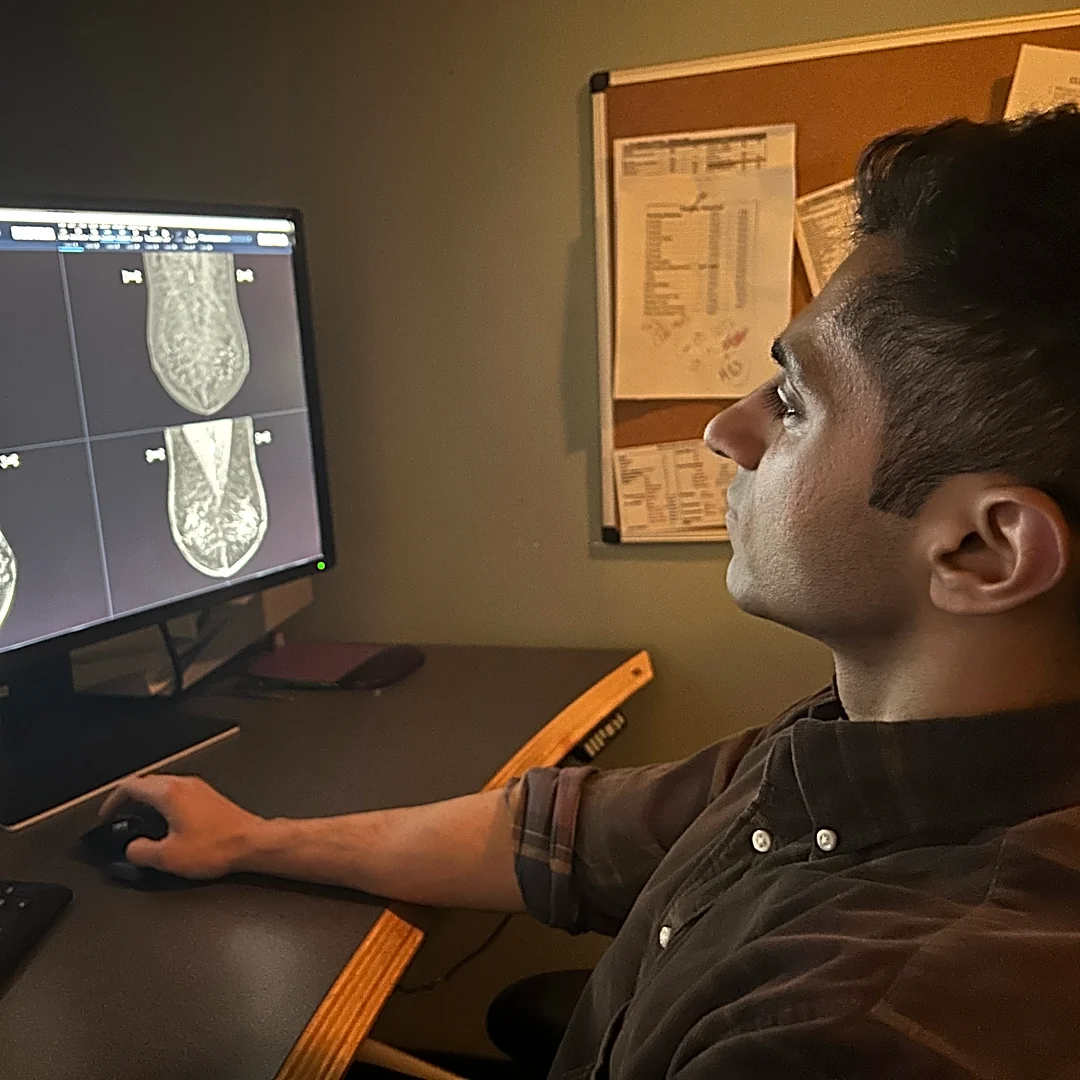 Why annual mammograms are still the gold standard | Exclusive