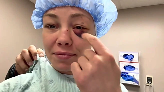 Rose Namajunas undergoes surgery after she was ‘poked in the eye a few times’ at UFC 324