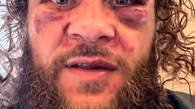 Battered Rafael Fiziev reacts to UFC 325 knockout loss – ‘Really took a beating’