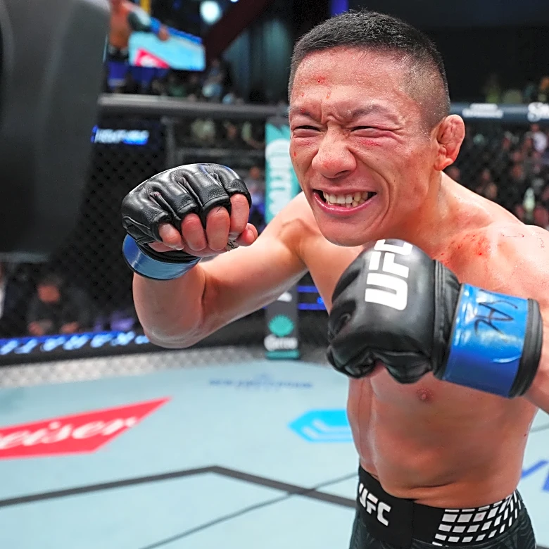 Pic: UFC Vegas 113’s Kyoji Horiguchi’s broken hand swollen like a balloon, potentially derailing title shot