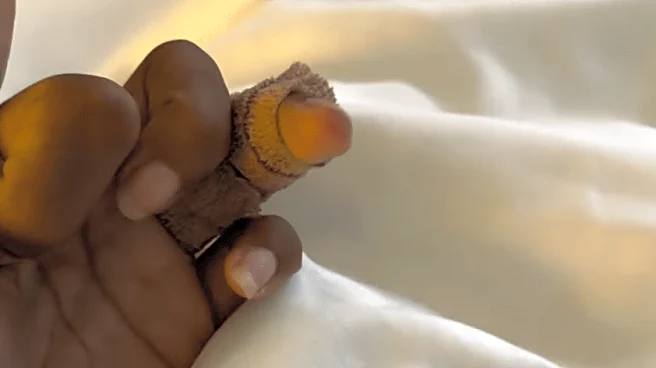 Bianca Belair struggling through injury rehab