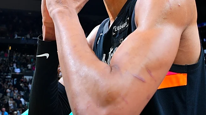 The San Antonio Spurs and the five stages of hope