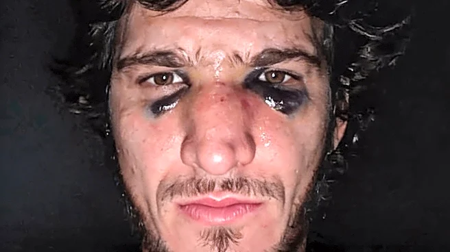 Pic: Movsar Evloev broke his nose four weeks before UFC main event