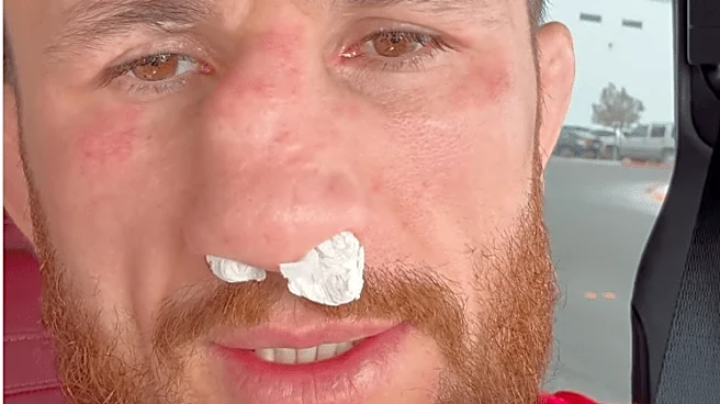 Merab Dvalishvili smashes nose in training, refusing surgery until retirement