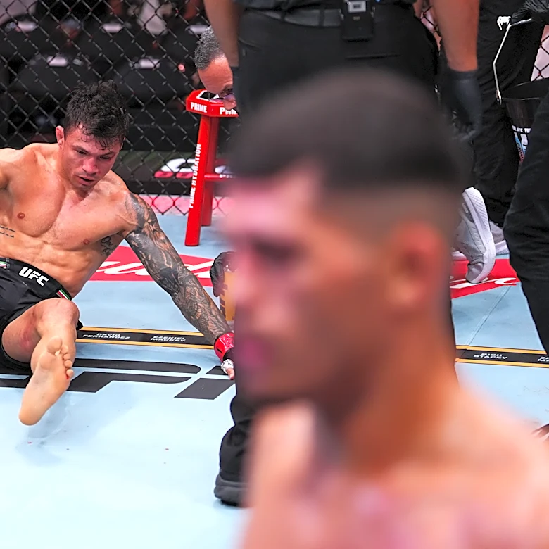 Alessandro Costa doesn’t regret ‘bad decision’ in fighting through gruesome injury: ‘We didn’t make the best call’