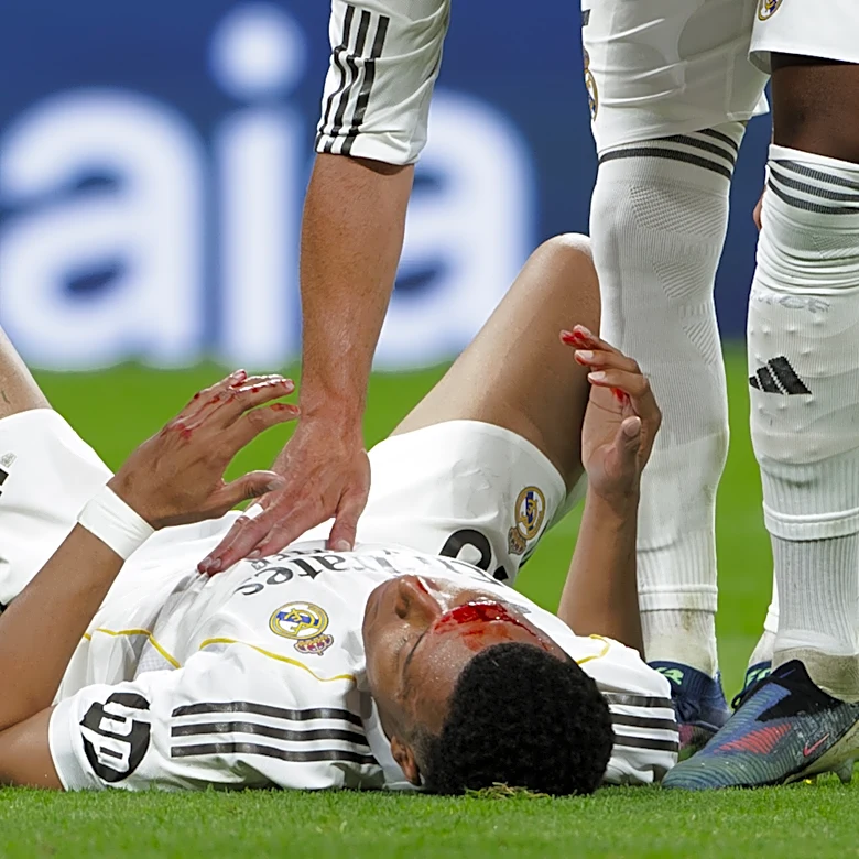 Kylian Mbappé misses Real Madrid training ahead of Bayern Munich tilt