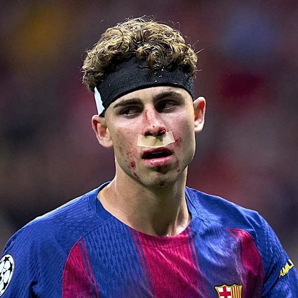 Fermin Lopez suffers gruesome injury after taking boot to the face for Barcelona against Atletico