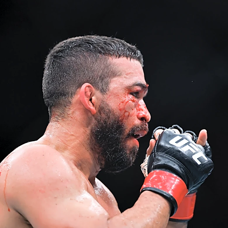 ‘Heartbroken’ Patricio Pitbull reveals broken orbital after UFC 327 loss — ‘I won’t talk about the title’