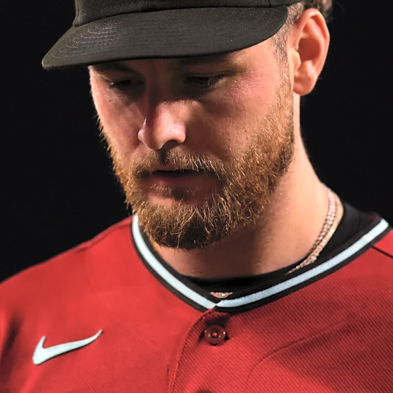 Arizona Diamondbacks News, 4/20: Blunt Force Trauma