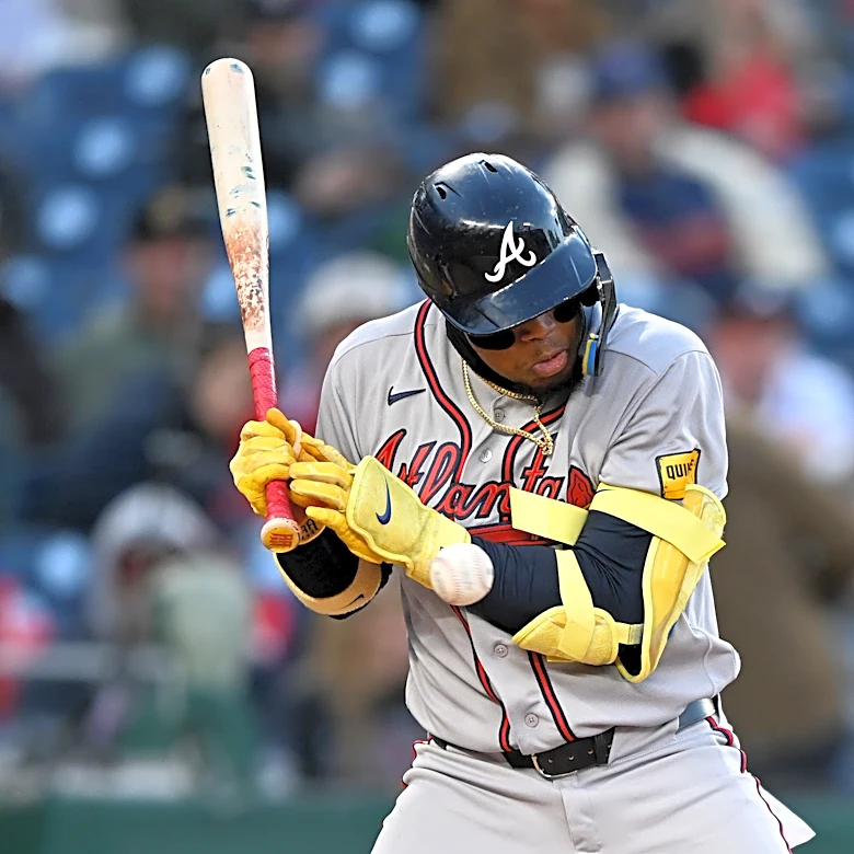 Ronald Acuńa, Jr. leaves game after being hit by pitch