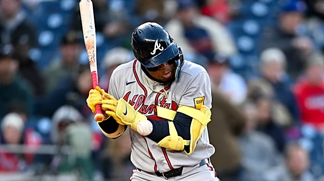 Ronald Acuńa, Jr. leaves game after being hit by pitch