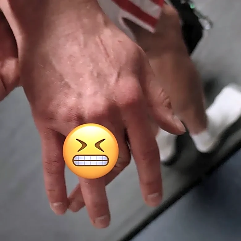 Perpendicular! Former Contender Series alum (and brother of hard-luck Harry Hardwick) shares photo of absolutely mangled finger | Pic