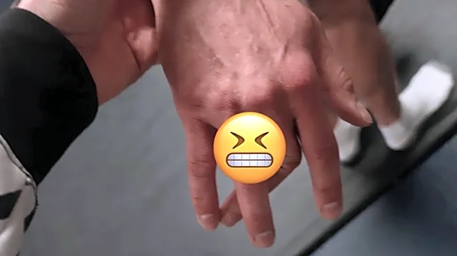 Perpendicular! Former Contender Series alum (and brother of hard-luck Harry Hardwick) shares photo of absolutely mangled finger | Pic