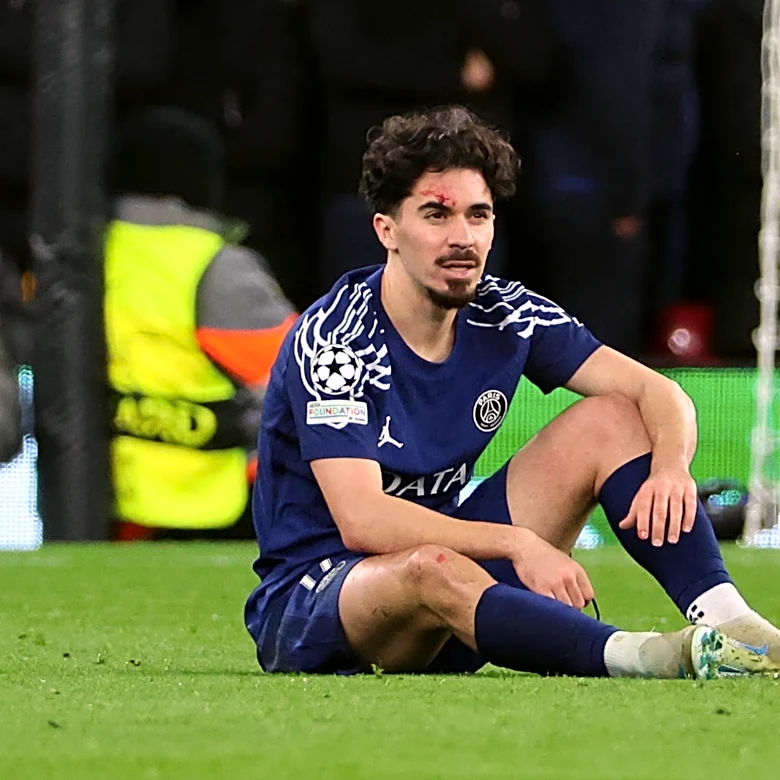 Bayern Munich’s Vincent Kompany plays coy with knowledge of Vitinha injury