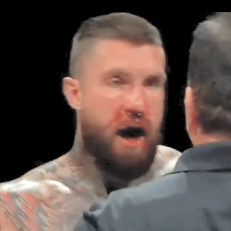 Video: Alex Terrible suffers multiple knockdowns before being stopped by Cameron Delano in Blood4Blood main event