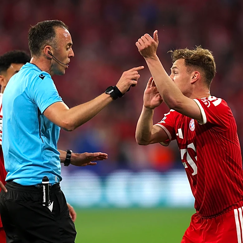 What does Bayern Munich need to improve most to win the Champions League next season?