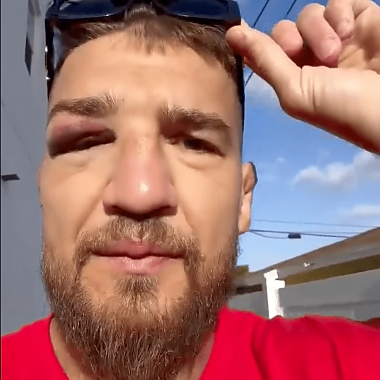 Yaroslav Amosov reveals injury suffered two weeks before UFC 328 win over Joel Alvarez