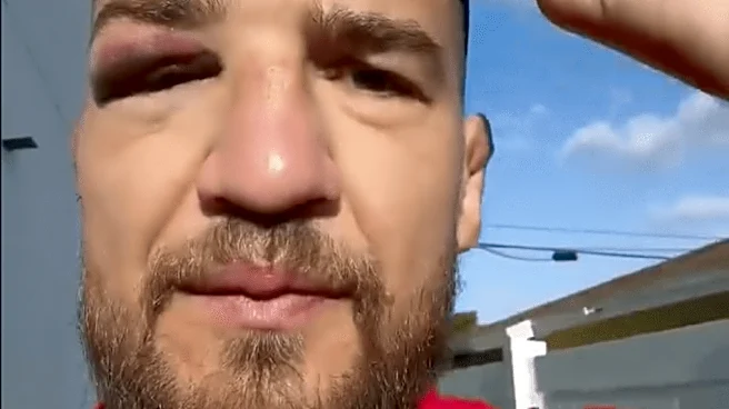 Yaroslav Amosov reveals injury suffered two weeks before UFC 328 win over Joel Alvarez