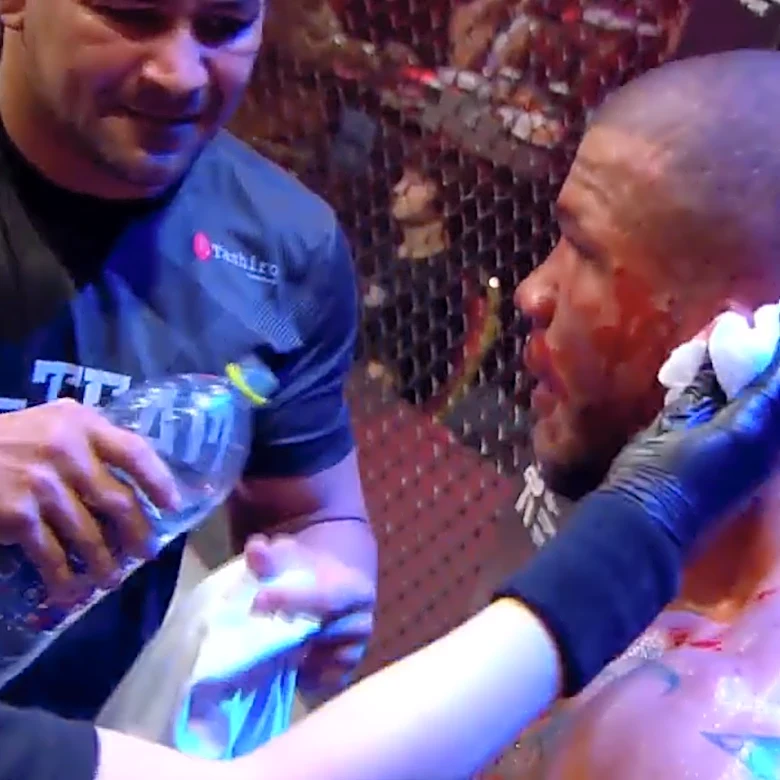 Missed Fists: Valmir da Silva loses fight after cauliflower ear explodes