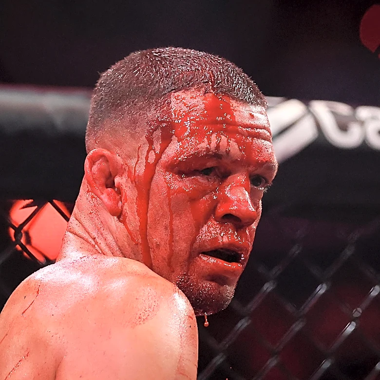 Nate Diaz scoffs at calls for retirement after Mike Perry loss: ‘This sh*t is forever’
