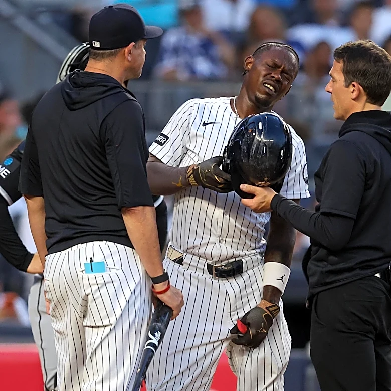 Yankees news: Jazz Chisholm Jr. says “no pain, no gain” after Thursday injury