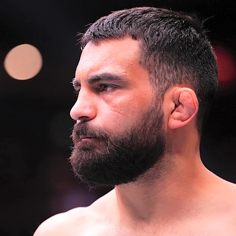 UFC 329’s Benoit Saint-Denis shuts down ‘ridiculous’ staph infection concerns – ‘I have a scab’