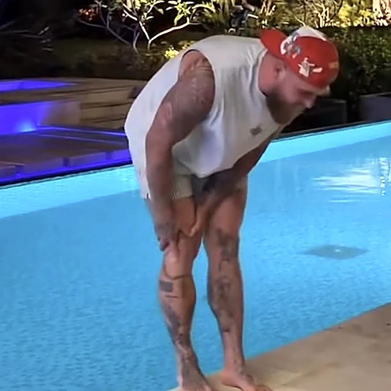 Jake Paul mocks Conor McGregor after injury ends his comeback at UFC 329