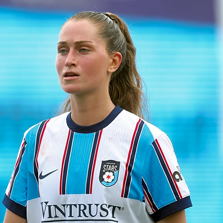 CANWNT and Chicago Stars forward Jordyn Huitema placed on season-ending injury list