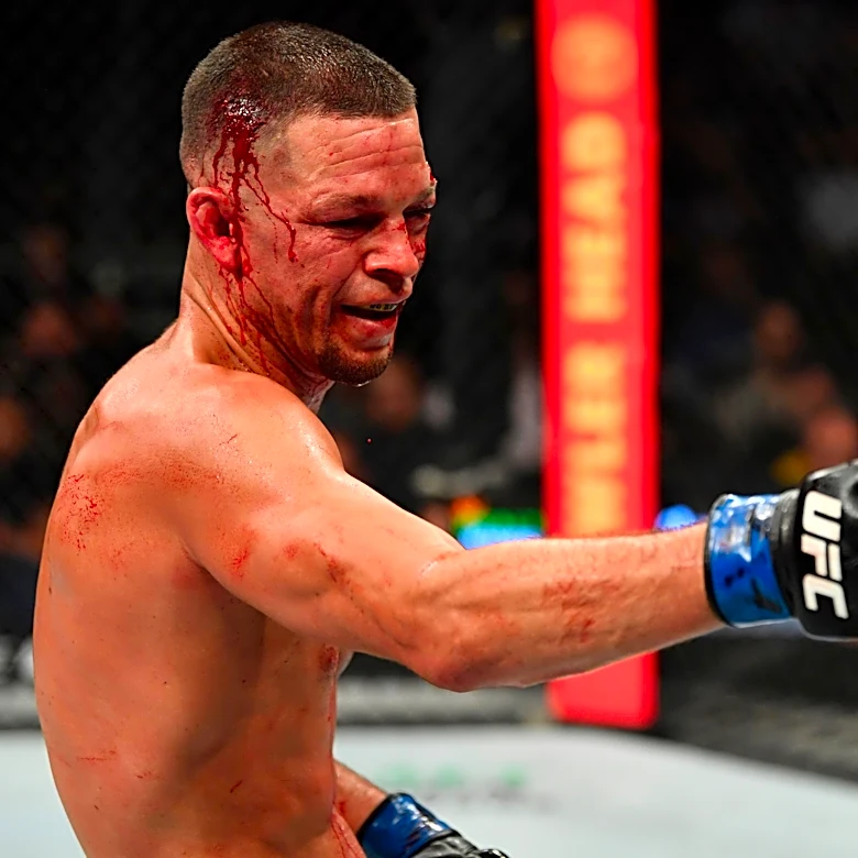 Pull up! Nate Diaz (finally) responds to Jake Paul callout following MVP-PFL merger