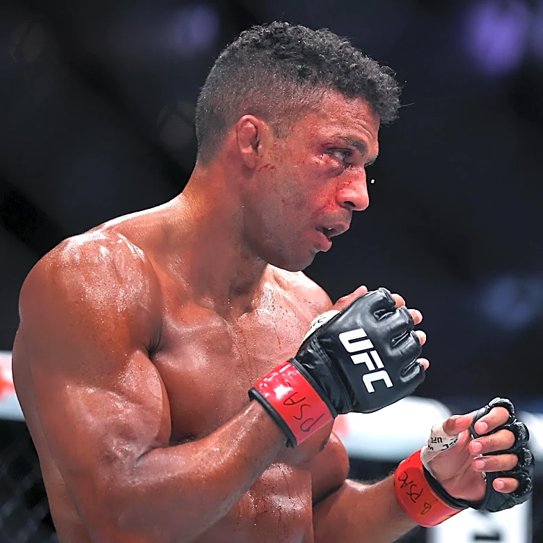 Edson Barboza reveals he was fighting half-blind for two years – ‘It’s been super hard’