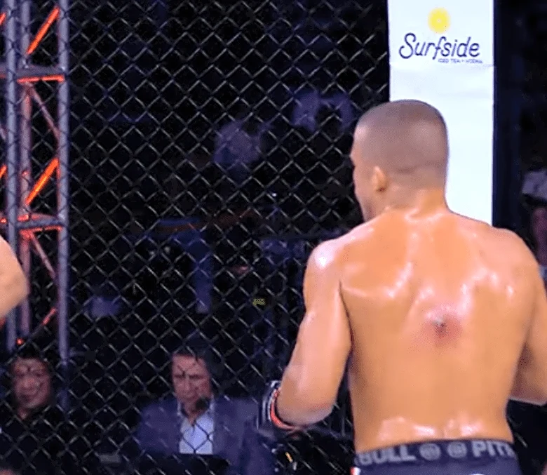 Worst ever? Fight fans react to ‘disgusting’ staph infection during LFA 239 main event, slam CSAC for allowing the fight