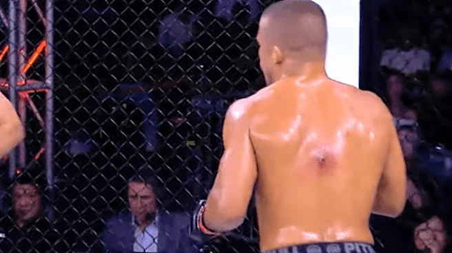 Worst ever? Fight fans react to ‘disgusting’ staph infection during LFA 239 main event, slam CSAC for allowing the fight