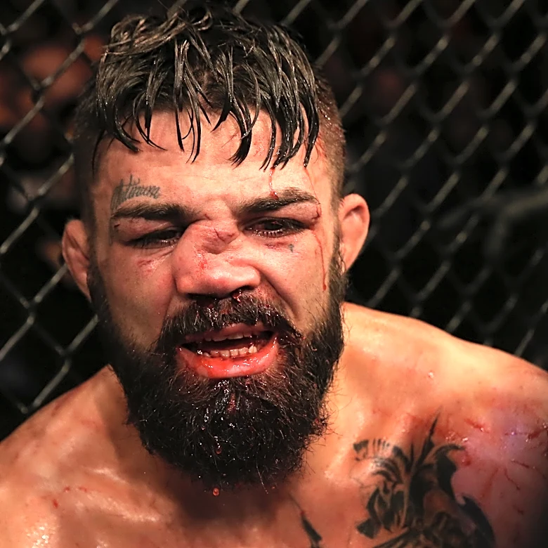 Highlights! Mike Perry suffers gnarly injury during shocking knockout loss to short-notice replacement Brandon Jenkins | Duel Arena 1