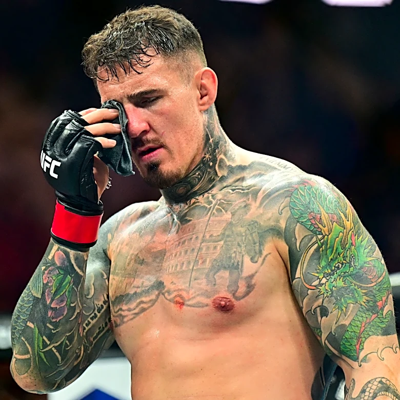 Eddie Hearn says Tom Aspinall still needs ‘additional testing’ on his eyes before fighting again