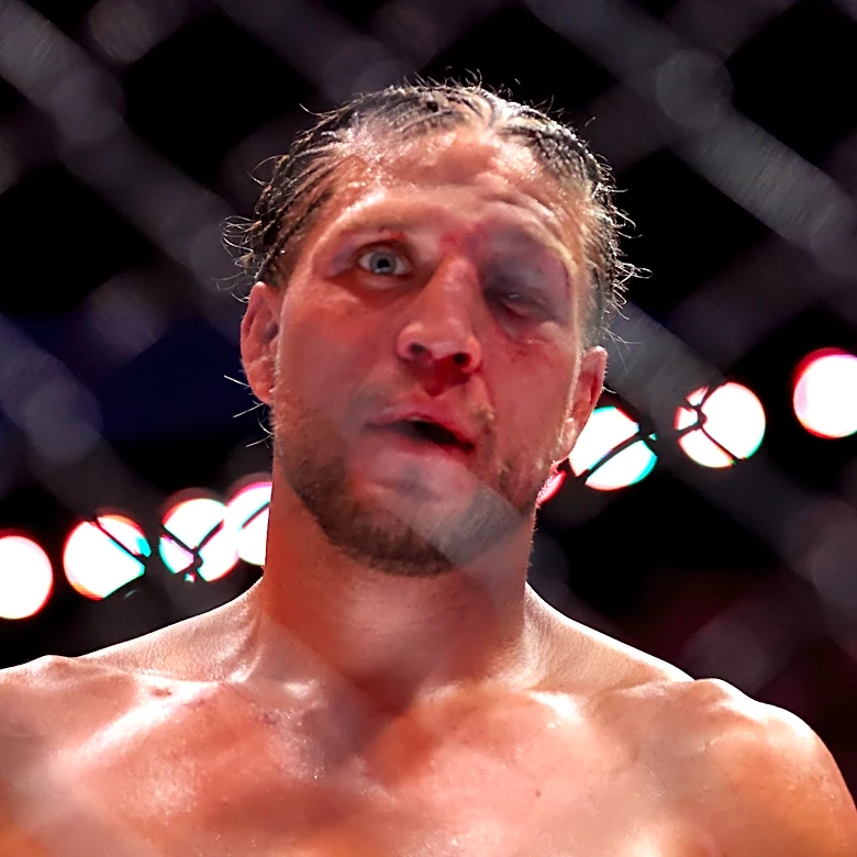 Brian Ortega reacts to last-second UFC 331 pullout: ‘This one hurts’