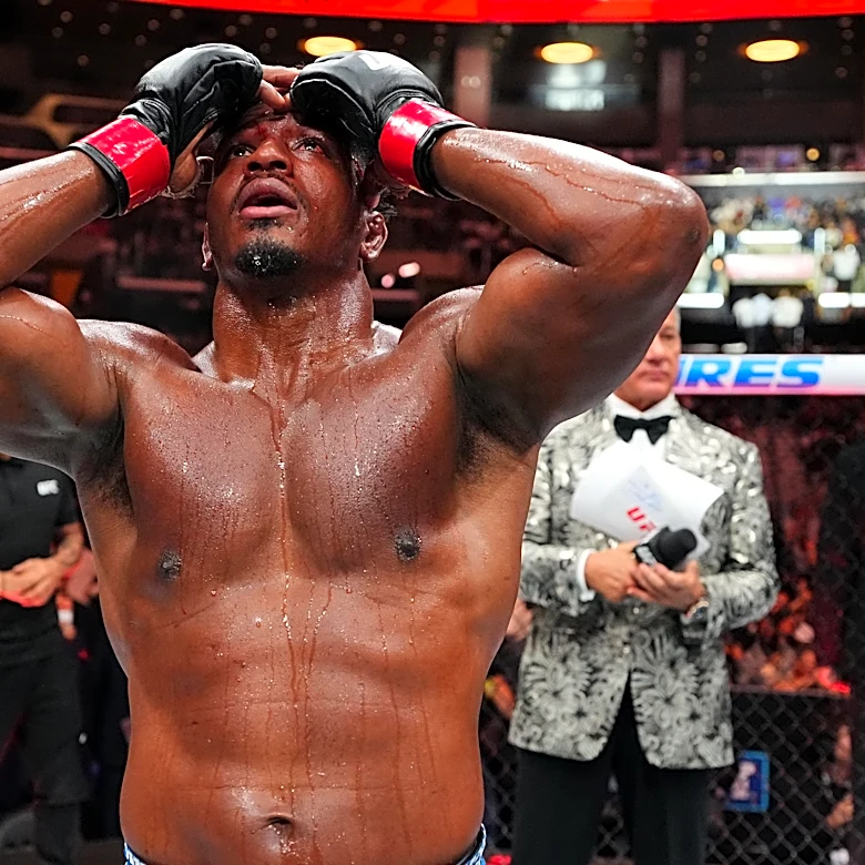 UFC 331 medical suspensions: Alonzo Menifield looking at 6 month suspension due gnarly broken thumb