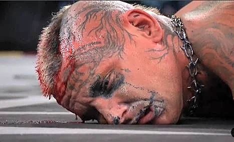 Good thing the AEW doctor was ringside for Darby Allin’s latest car crash title match