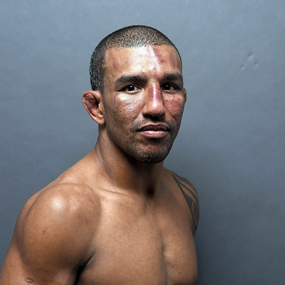 Raoni Barcelos admits retirement ‘hasn’t been ruled out’ as medical tests continue