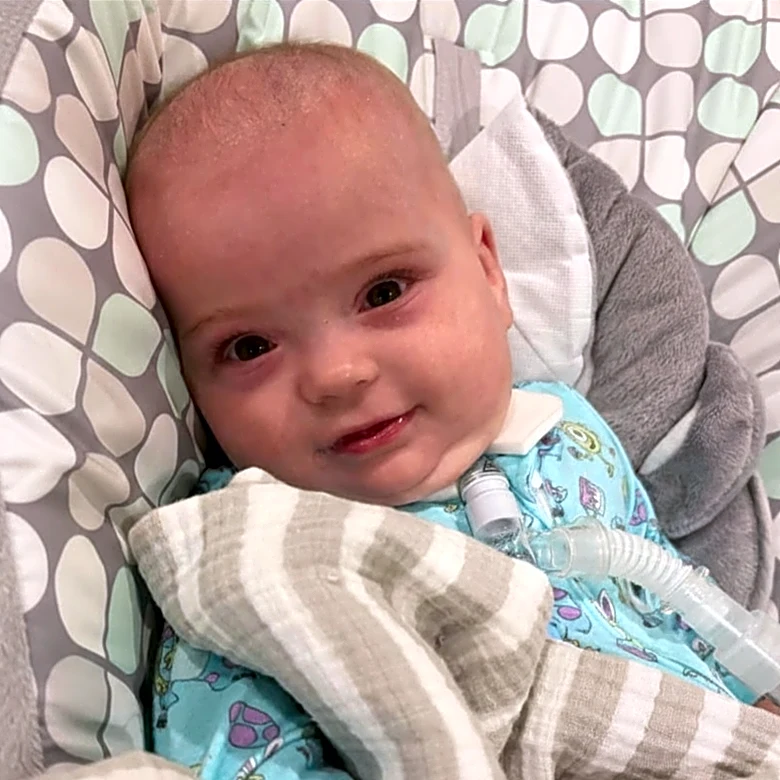 Infant's inspiring path from fragile start to growing independence