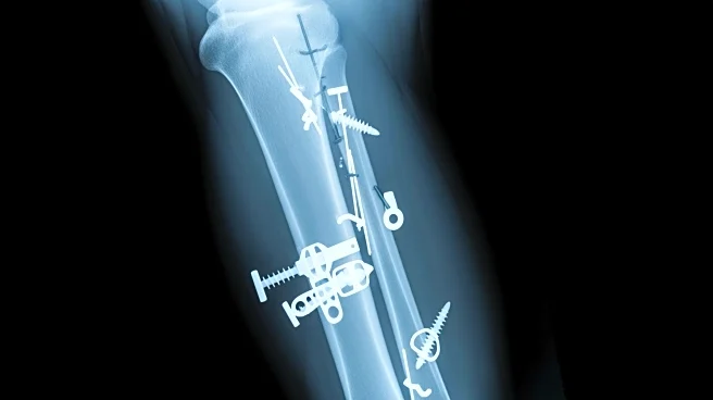 Lindsey Vonn Undergoes Multiple Surgeries for Olympic Leg Injury, Shares X-Ray