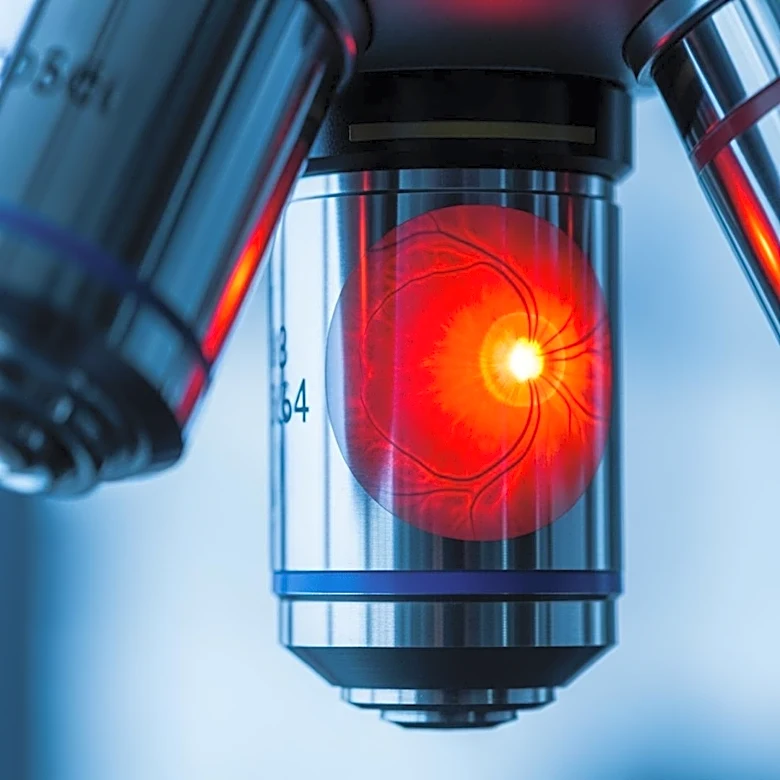 Iridex Corporation Reports Narrowed Q4 Loss Amid Retina Sales Growth