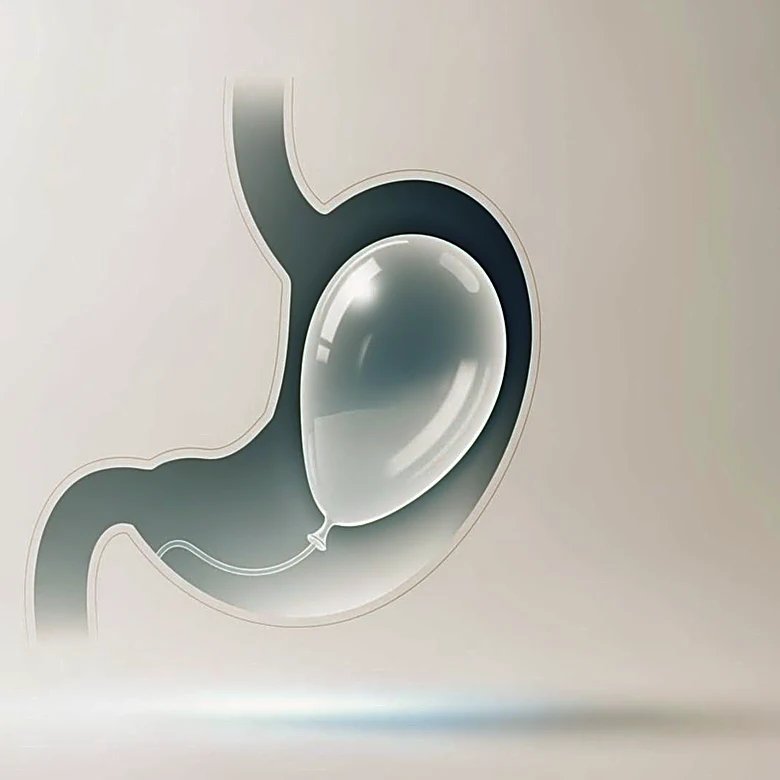 Allurion Launches First Commercial Treatments in U.S. with Gastric Balloon System