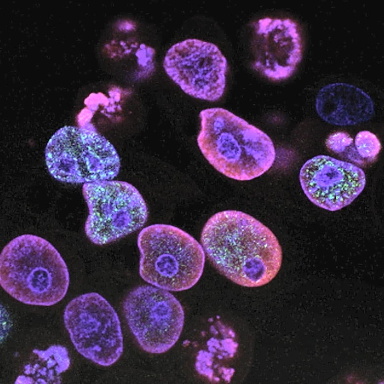 Scientists Identify Brain Cells Linked to Depression