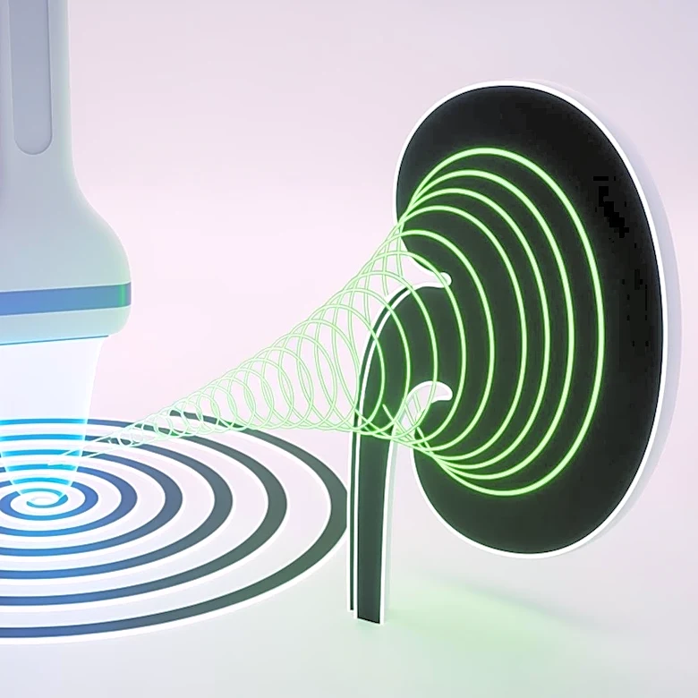 HistoSonics Seeks FDA Approval for Kidney Tumor Treatment with Histotripsy