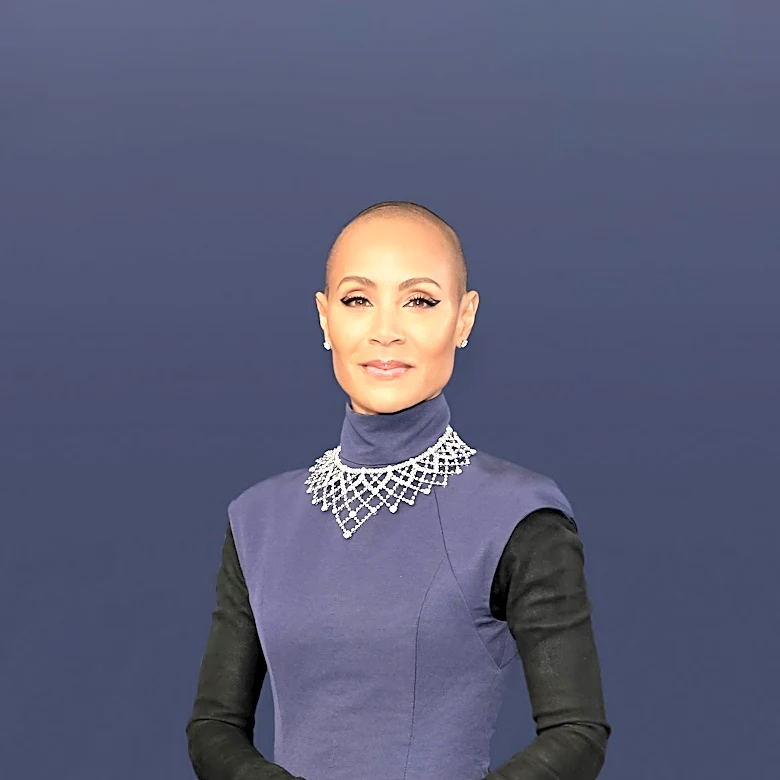 Women with Alopecia Challenge Beauty Norms Through New Organization