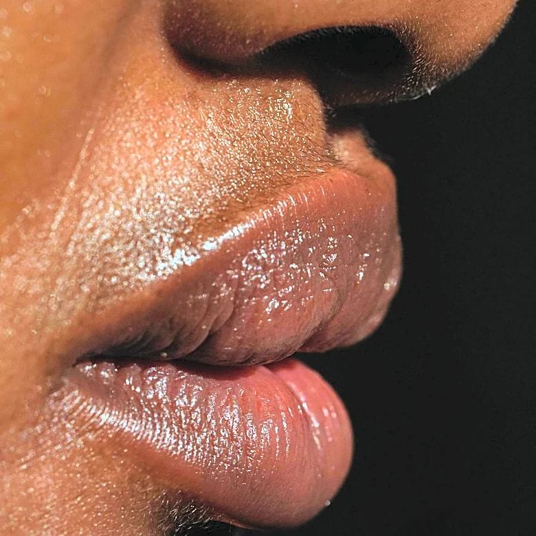 Lymphatic Drainage Therapy Enhances Rhinoplasty Recovery in Los Angeles