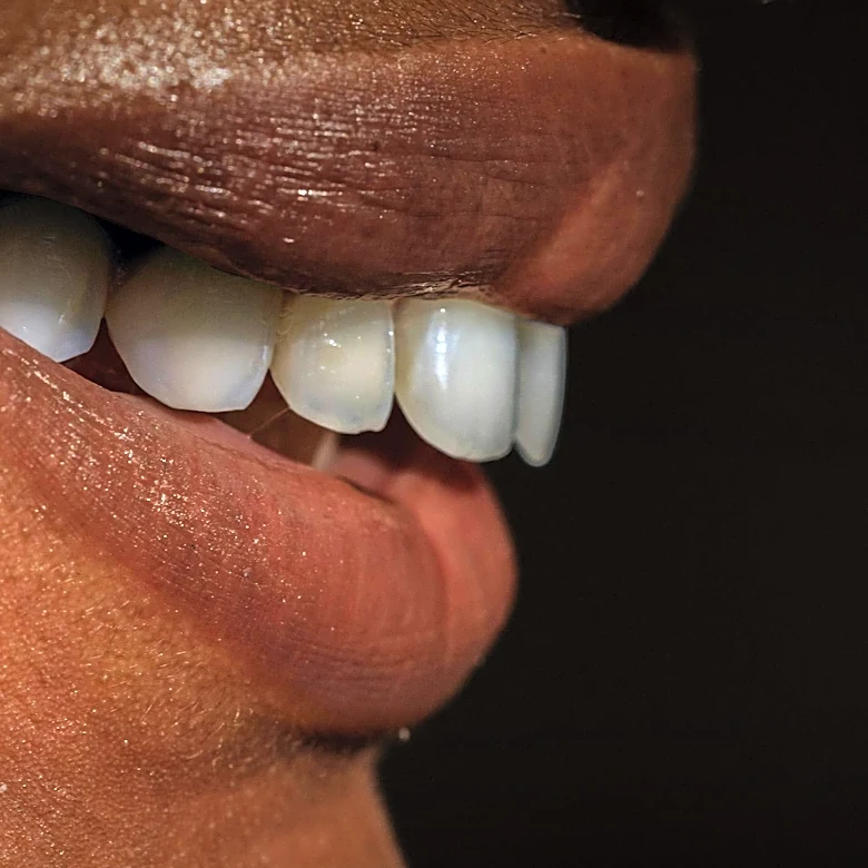 AbbVie's Botox Nears Approval for New Aesthetic Use
